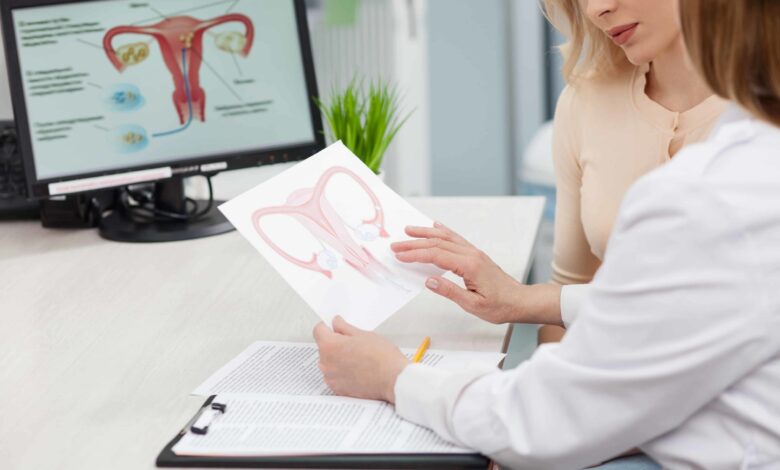Ovarian Cyst