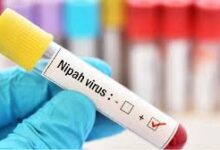 Nipah Virus
